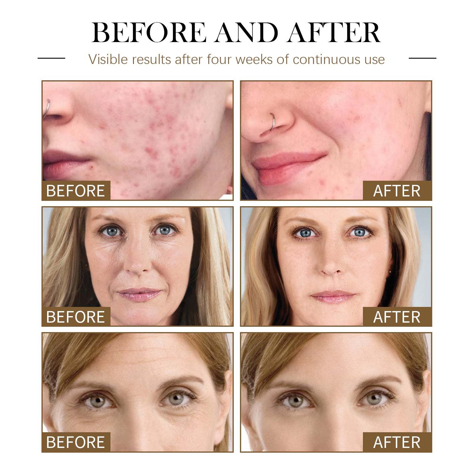 Jaysuing Facial Moisturizing Essential Oil Facial Hydrating and Firming Wrinkle Fading Essential Oil